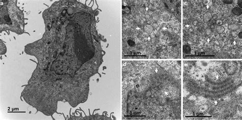 Early Ultrastructural Changes Encountered In Vero Cells At H