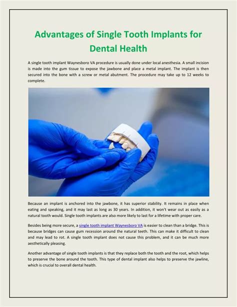 PPT Advantages Of Single Tooth Implants For Dental Health PowerPoint