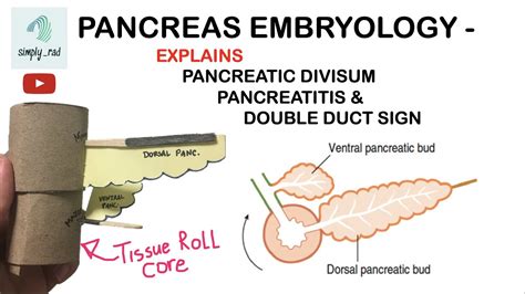 Annular Pancreas Embryology