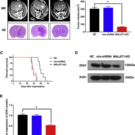 Knockdown Of MALAT1 Inhibited GBM Progression And ZHX1 Expression In