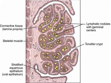 Tonsil Stones Causes Symptoms Diagnosis And Tonsil Stones Treatment