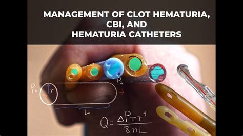 Management Of Clot Urinary Retention CBI And Hematuria Catheters