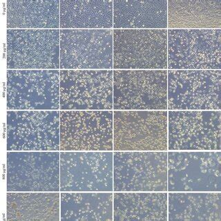 Phase Contrast Microscopic Images Of MG 63 Osteosarcoma Cells Treated