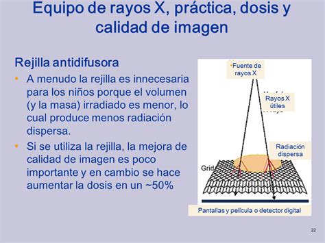 Protecci N Radiol Gica P Gina