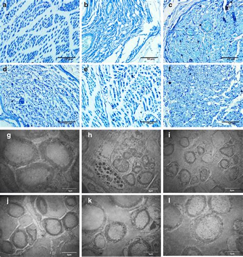 Histology Of Regenerated Axons For Toluidine Blue Staining In The Download Scientific Diagram