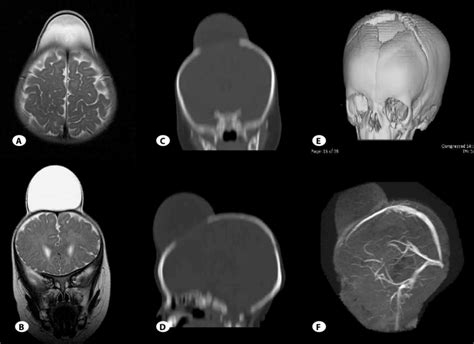 Depicts The Radiology In Case 2 Ab Reveal The Axial And Coronal