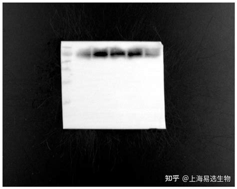 为什么western Blot 的条带有很多非特异性条带？有可能是一抗的原因吗？ 知乎