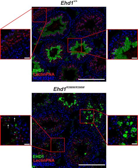 Frontiers A Missense Mutation In Ehd Associated With Defective