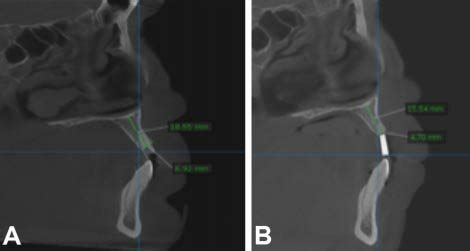 Tomograf A Computarizada De Haz C Nico Cbct Grupo B T Cnica