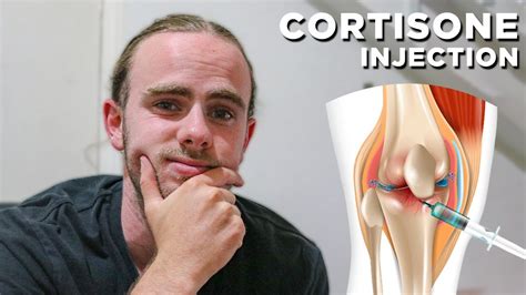 The Cortisone Injection in My Knee... - YouTube