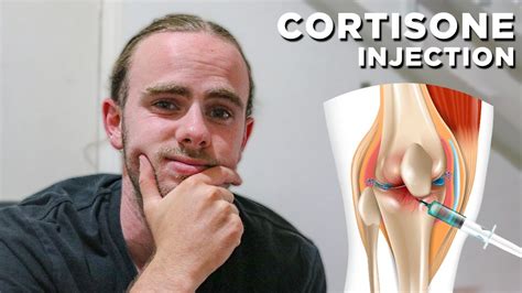 The Cortisone Injection in My Knee... - YouTube