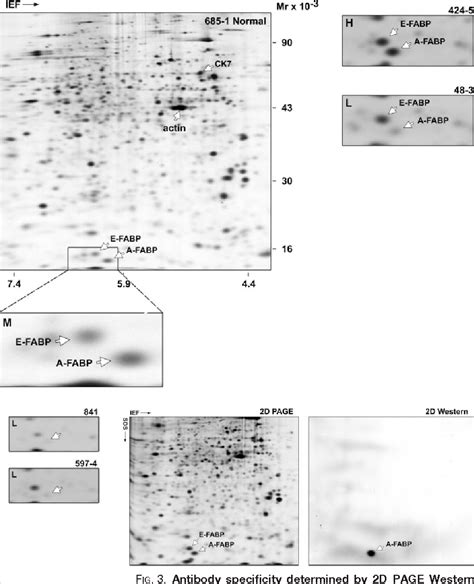 Figure 3 From Loss Of Expression Of The Adipocyte Type Fatty Acid