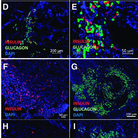 Normal Islet Hormone Expression And Viability After Intracutaneous