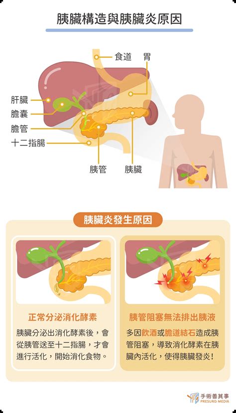 胰臟炎會自己好嗎？急性與慢性胰臟炎症狀、原因、治療一次看