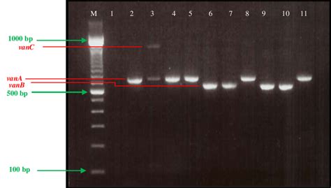 Gel Electrophoresis Of Dna Fragments Generated By Mpcr Amplification Download Scientific