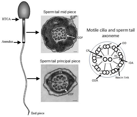 Diagnostics Free Full Text Diagnostics And Management Of Male