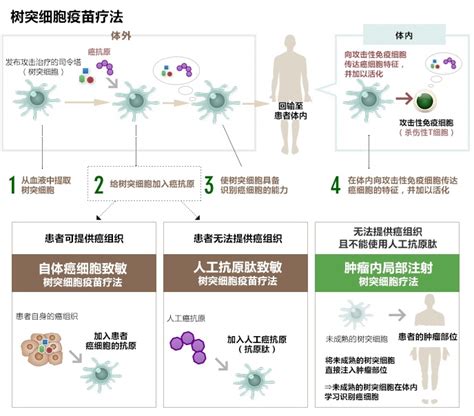 日本免疫细胞疗法之树突细胞疗法（dc疫苗） 日本劳动厚生省认定【日本就医网】