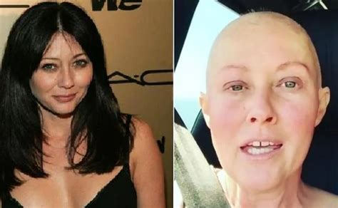 Shannen Doherty Actriz De Embrujadas Se Somete A Una Reconstrucci N