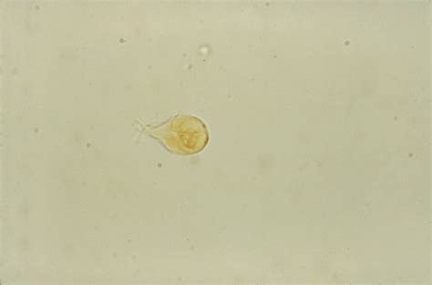 Free Picture Photomicrograph Giardia Lamblia Trophozoites Small Intestine Infection Host