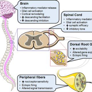 (PDF) Neuropathic Pain: Central vs. Peripheral Mechanisms