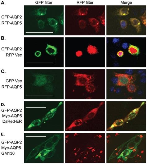 Ac Representative Confocal Microscopy Images Showing Colocalization