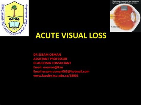 Ppt Acute Visual Loss Powerpoint Presentation Free Download Id1858408