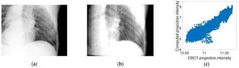 Fluoroscopic D Image Generation From Patient Specific Pca Motion