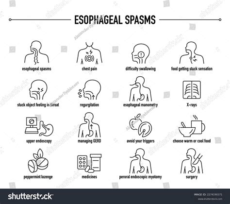 Esophageal Spasms Symptoms Diagnostic Treatment Vector Stock Vector