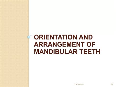 Arrangement of teeth in complete denture | PPTX