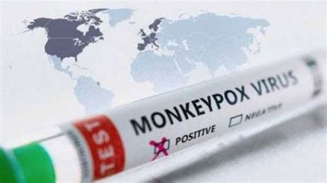 European Union Approves Bavarian Nordic S Monkeypox Vaccine American