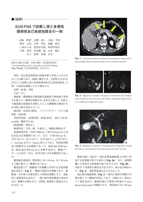 Pdf Autoimmune Pancreatitis With Multifocal Mass Lesions Diagnosed By Endoscopic