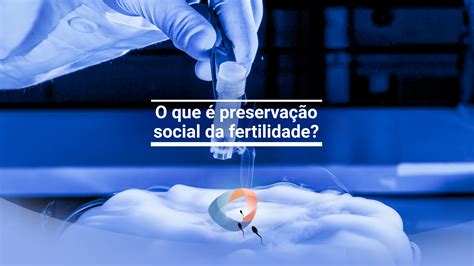 O Que Preserva O Social Da Fertilidade Dr Augusto Bussab