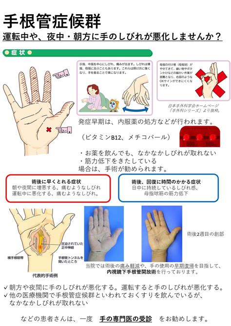 手の病気にまつわるお話 手根管症候群など手の病気を治療する 茨城県の手外科専門医 若杉琢磨