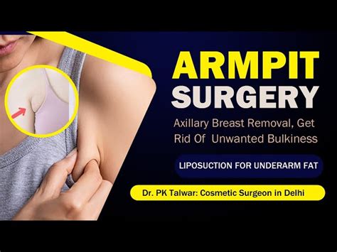 Armpit Fat Removal