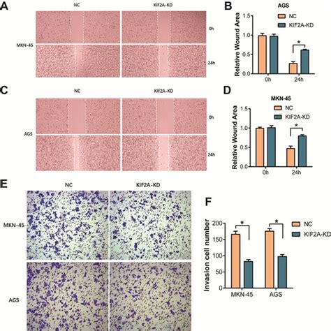 RNAi Mediated KIF2A Knockdown Inhibited The Migration And Invasion