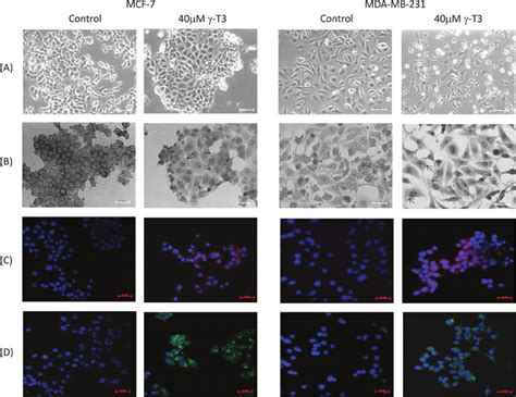 Mcf 7 And Mda Mb 231 Breast Cancer Cell Were Treated With 040 ␮ Moll