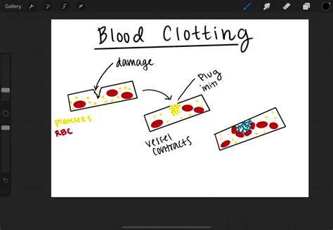 SOLVED DIC Is A Disorder In Which A The Coagulation Pathway Is