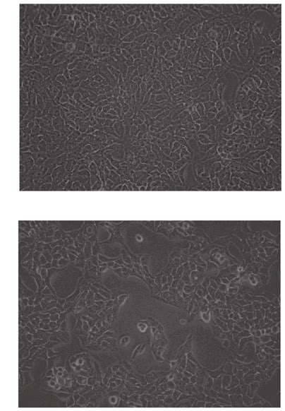 Morphological Analysis Of A Cells Following Metformin Treatment