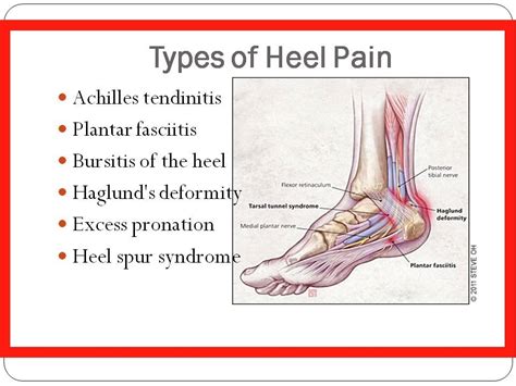 Foot Anatomy Heel Pain