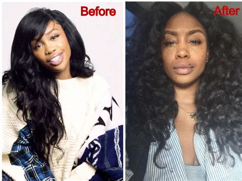 Sza Before Plastic Surgery Astonishing Look