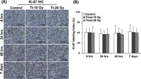 Microscopy Images And Quantitative Analysis Of Ki 67 Labeling Index Download Scientific