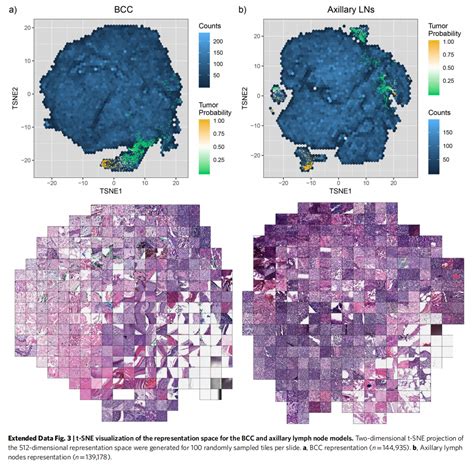 Clinical Grade Computional Pathology Using Weakly Supervised Deep Learning On Whole Slide Images