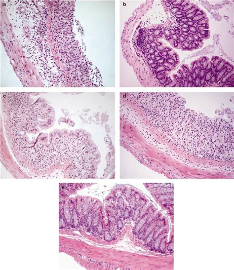 DSS Histopathology Of The Distal Colon A D H E Histopathology