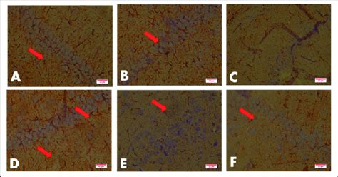 Photomicrographs of the CA 1 of the Hippocampus Showing the Expression ... 