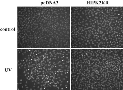 Homeodomain Interacting Protein Kinase 2 Mediates Ctbp Phosphorylation