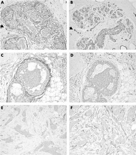 Fibroblasts Are Cd34 Positive Around A Normal Breast Ducts And