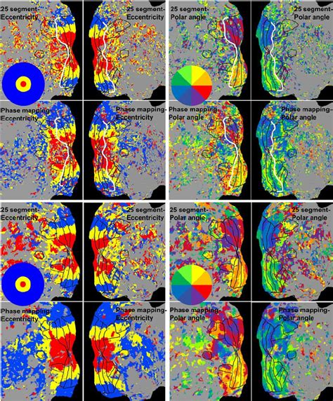 Retinotopic Maps From One Subject On Fl At Brain Surfaces Black