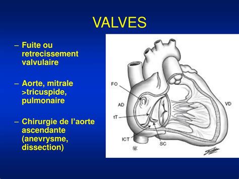 PPT La Chirurgie Cardiovasculaire PowerPoint Presentation Free