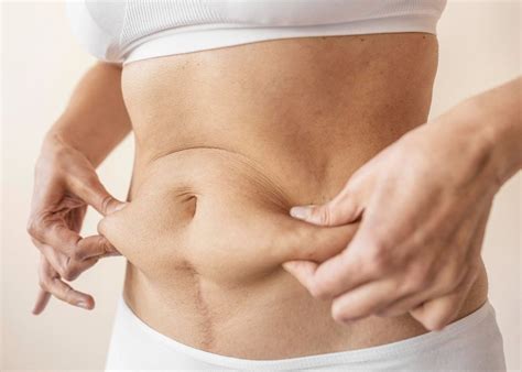 Tummy Tuck Surgery Siam Clinic Aesthetic Wellness Clinic In Phuket