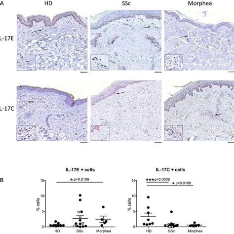 High Frequency Of IL 17E And Low Frequency Of IL 17C Cells